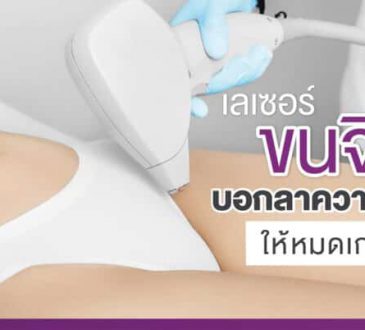 APEX Medical Center เลเซอร์ขนจิมิ บอกลาความแพลม เรียบเนียน