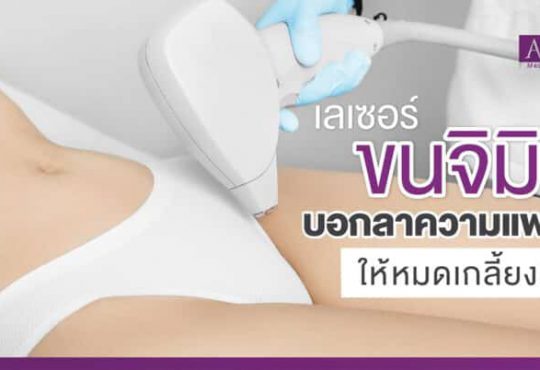 APEX Medical Center เลเซอร์ขนจิมิ บอกลาความแพลม เรียบเนียน