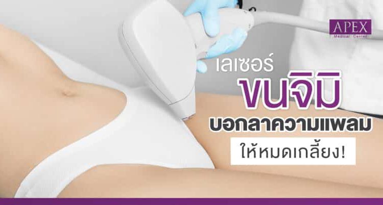 APEX Medical Center เลเซอร์ขนจิมิ บอกลาความแพลม เรียบเนียน
