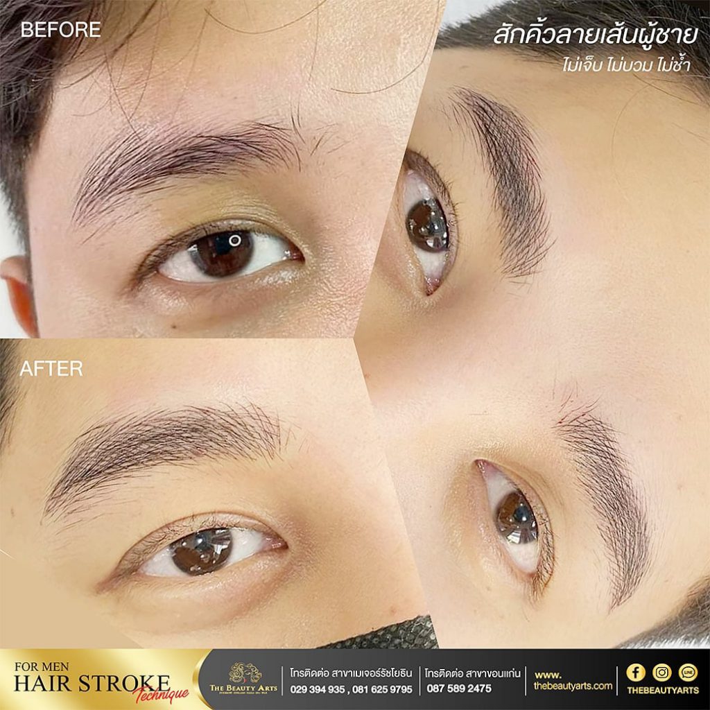 The Beauty Arts คลินิกสักคิ้วผู้ชาย - 2