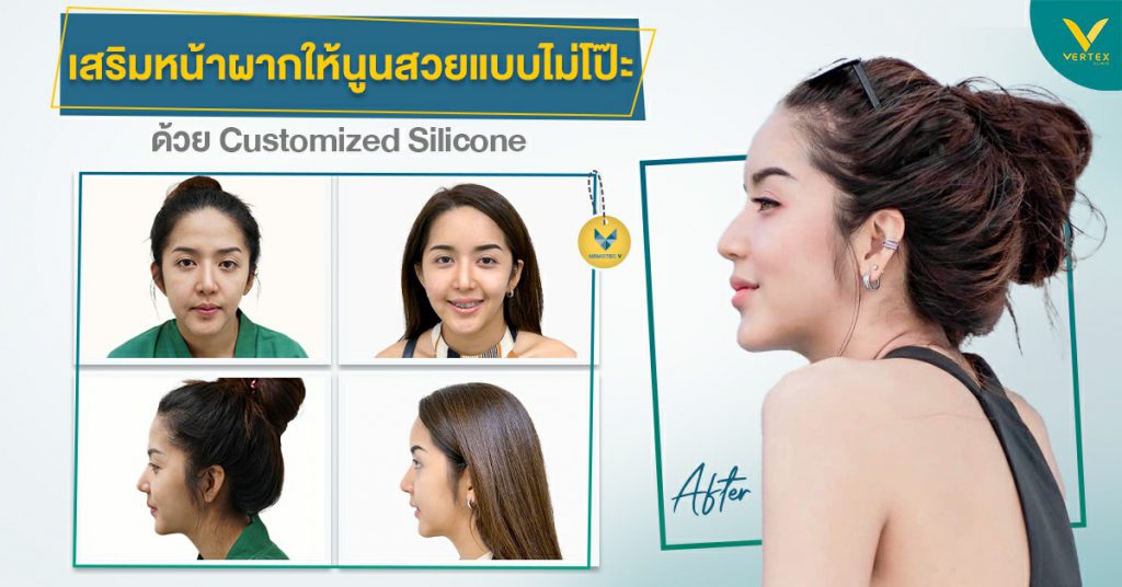 VERTEX Clinic คลินิกเสริมหน้าผากซิลิโคน - 2