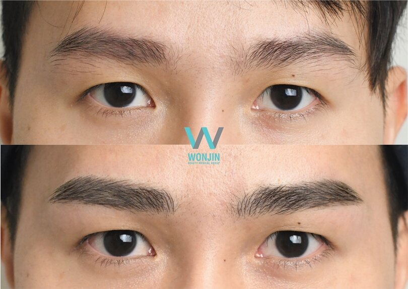 Wonjin Beauty Medical Group คลินิกสักคิ้วผู้ชาย - 2