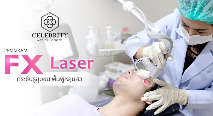 Celebrity Clinic บริการเลเซอร์สิวอุดตัน - 2