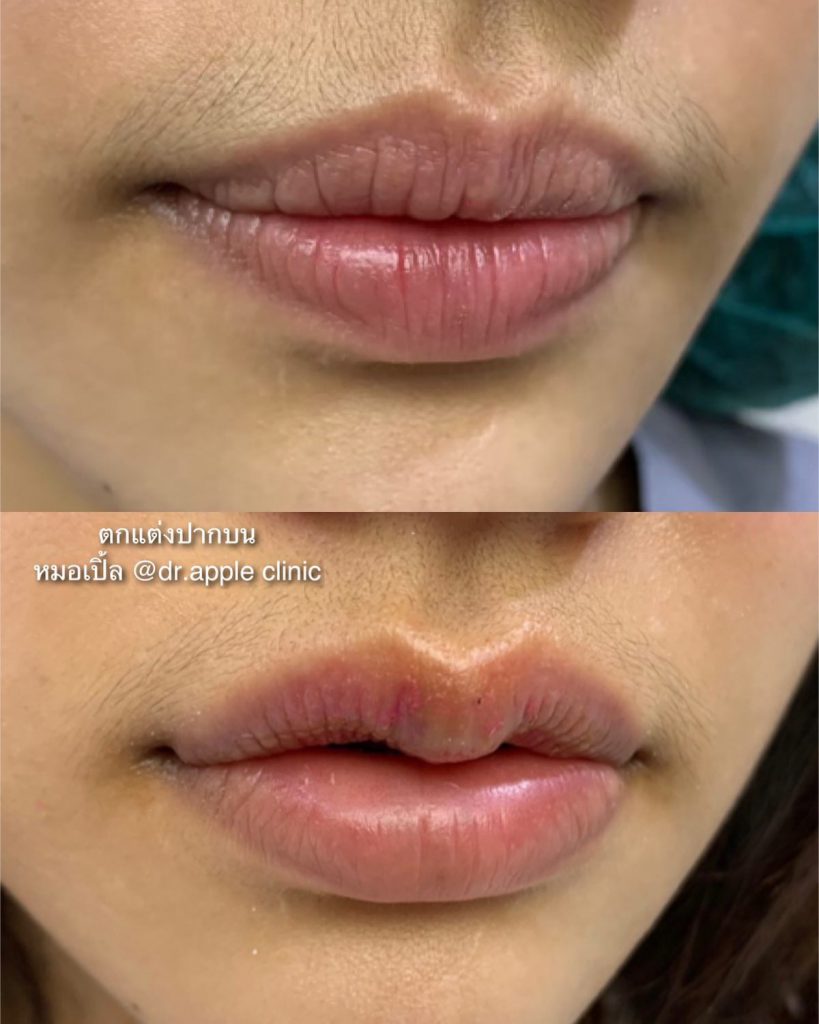 Dr. Apple Clinic คลินิกทำปากกระจับ - 2