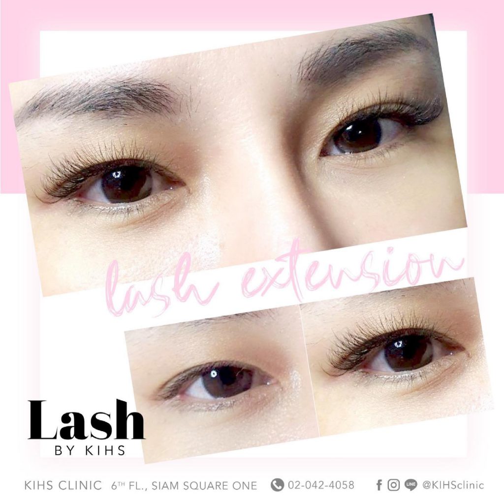 KIHS Clinic คลินิกลิฟติ้งขนตา - 2