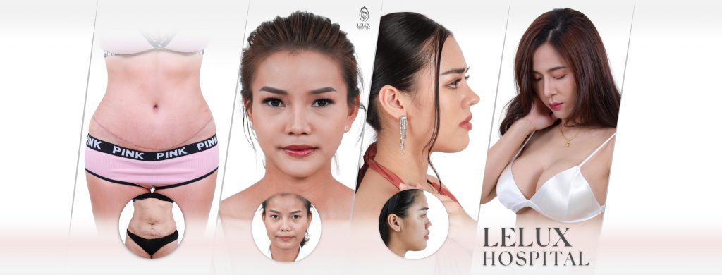 Lelux Hospital บริการทำปากกระจับ - 1