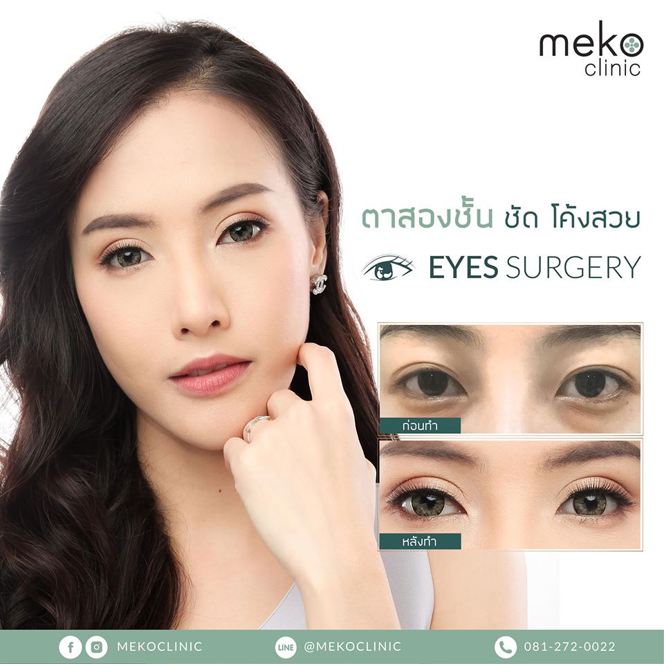 Meko Clinic บริการทำตา 2 ชั้น - 2