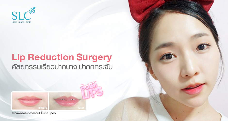 SLC Clinic ศัลยกรรมทำปากกระจับ - 1