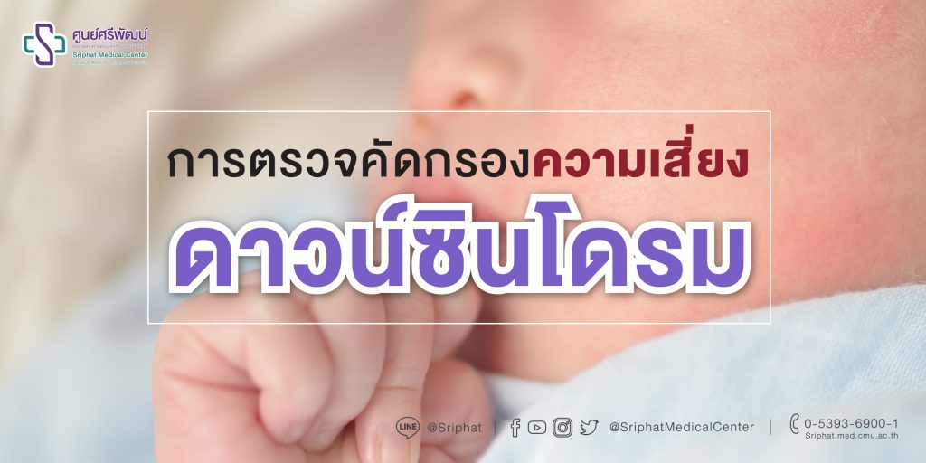Sriphat Medical Center บริการตรวจดาวน์ซินโดรม - 1