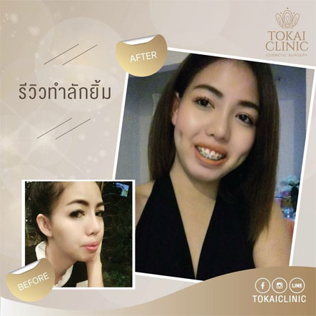 Tokai Clinic บริการทำลักยิ้ม - 2