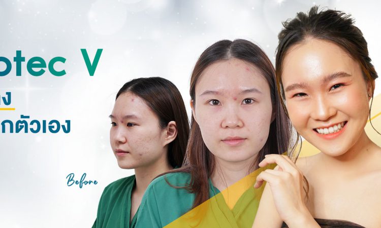 Vertex Clinic คลินิกเสริมคาง ให้ผลลัพธ์ของใบหน้าได้ออกมาดูดีที่สุด - 1