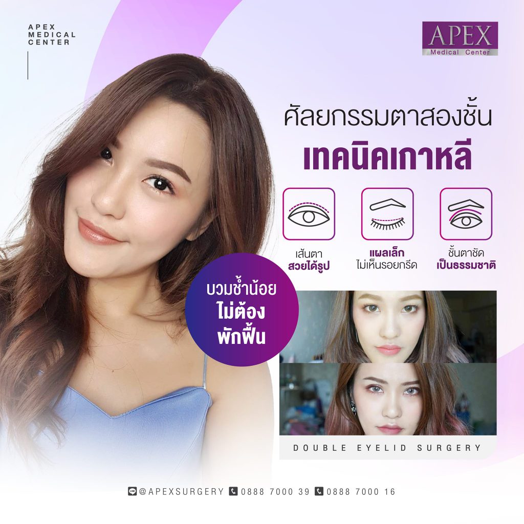 Apex Medical Center บริการทำตาสองชั้น สไตล์เกาหลี - 2