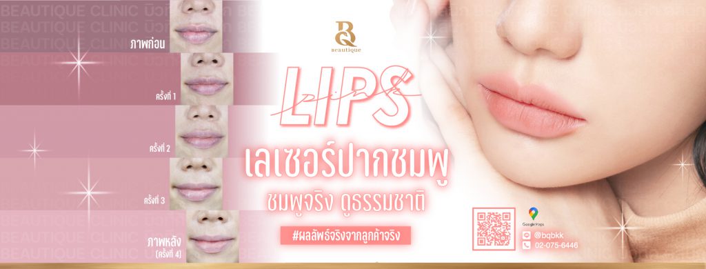 Beautique Aesthetic Center บริการเลเซอร์ปากชมพู - 1
