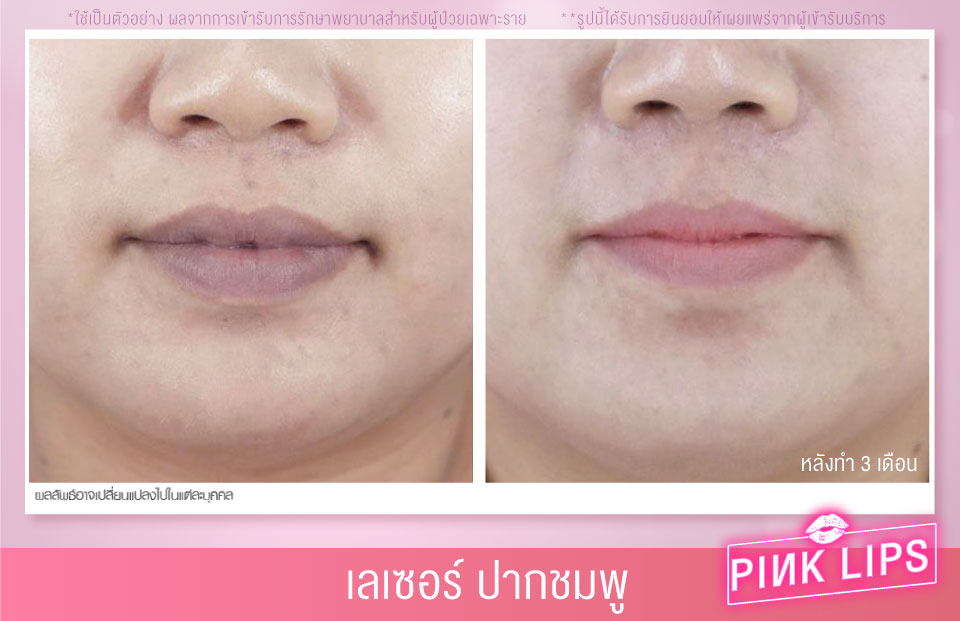 Cosmacare Clinic คลินิกเลเซอร์ปากชมพู - 2