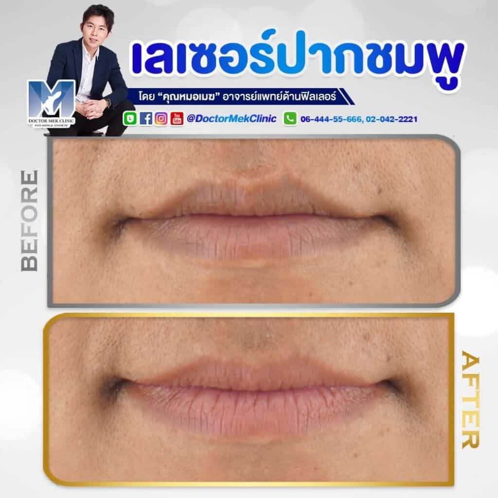 Doctor Mek Clinic คลินิกเลเซอร์ปากชมพู - 2