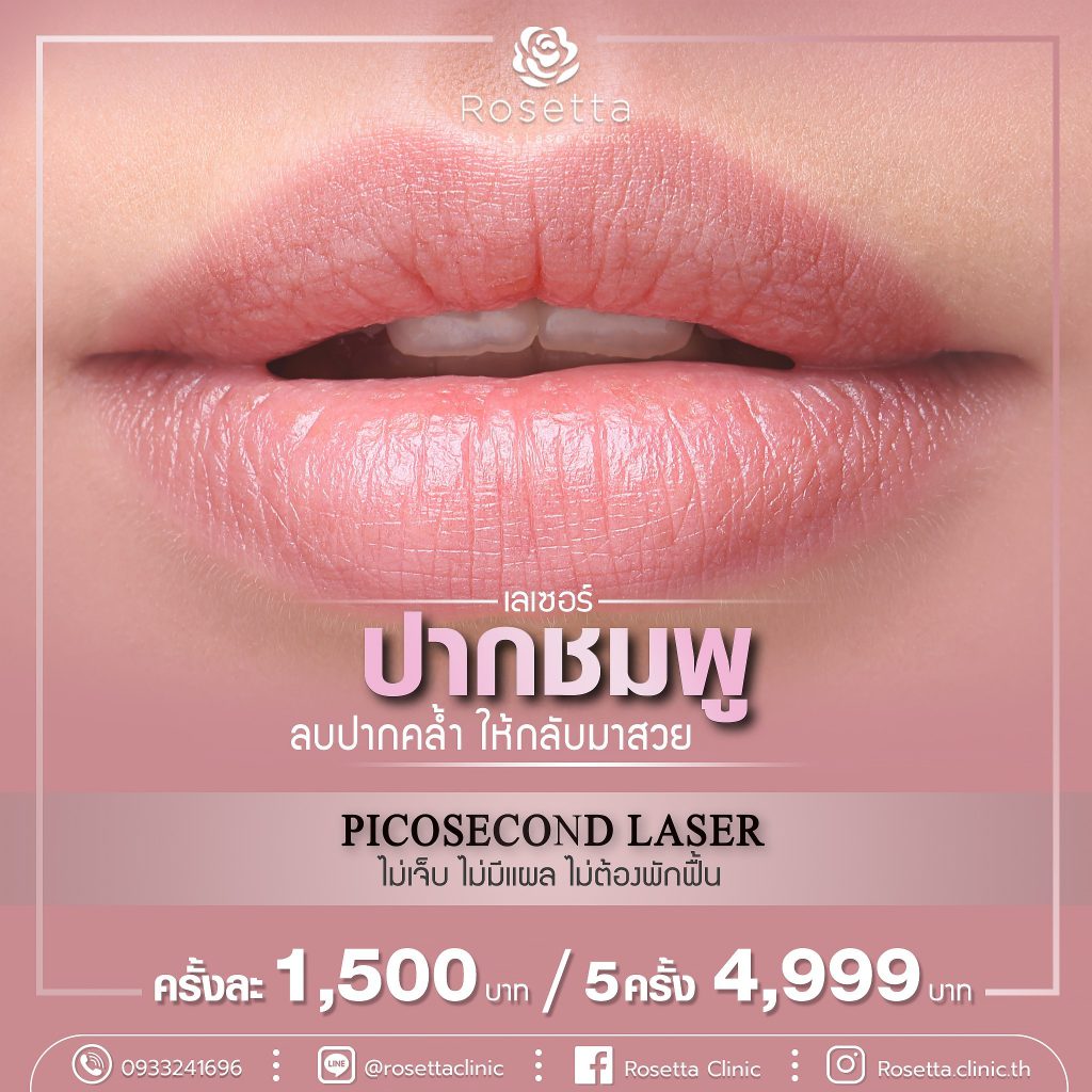 Rosetta Clinic บริการเลเซอร์ปากชมพู - 2