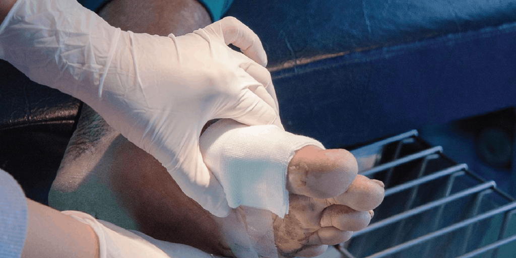 รักษาแผลเบาหวาน ที่ไหนดี