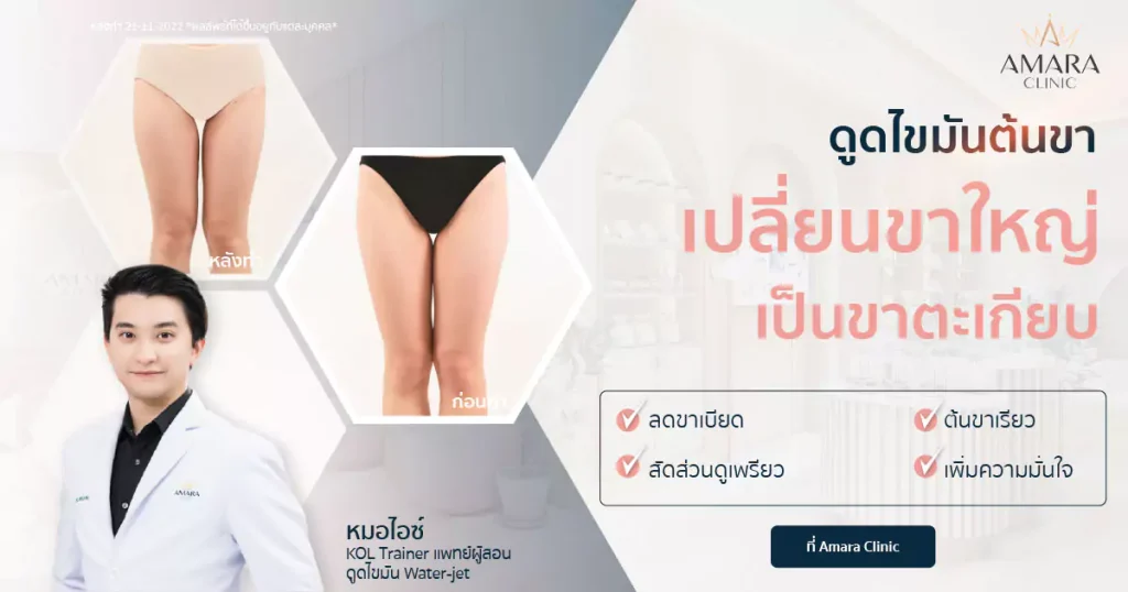 Amara Clinic ดูดไขมันต้นขา เปลี่ยนขาใหญ่เป็นขาตะเกียบทรงดี - 1