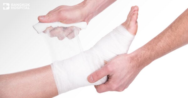 Bangkok Hospital ศูนย์รักษาแผลเบาหวาน รักษาทุกอาการของแผลโรคที่เป็น