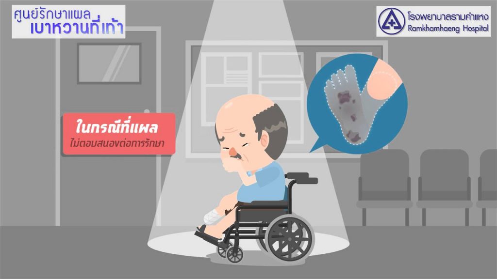 Ramkhamhaeng Hospital ศูนย์รักษาแผลเบาหวาน การรักษาโดยใช้ ABI และ PWV