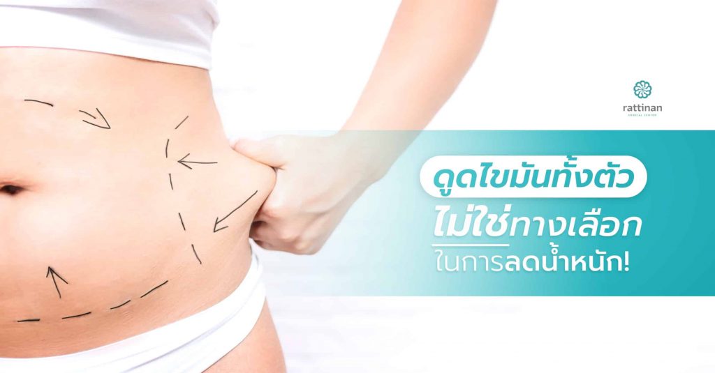 Rattinan Clinic คลินิกดูดไขมันหน้าท้อง ลดการเกิดไขมันสะสม ไขมันส่วนเกินให้หมดไป - 1