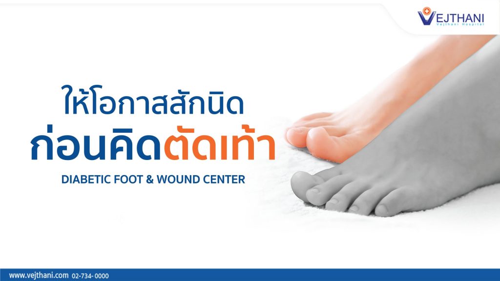 Vejthani Hospital ศูนย์รักษาแผลเบาหวาน รักษาหายได้ บรรเทาอาการที่เป็นชะงักทันที