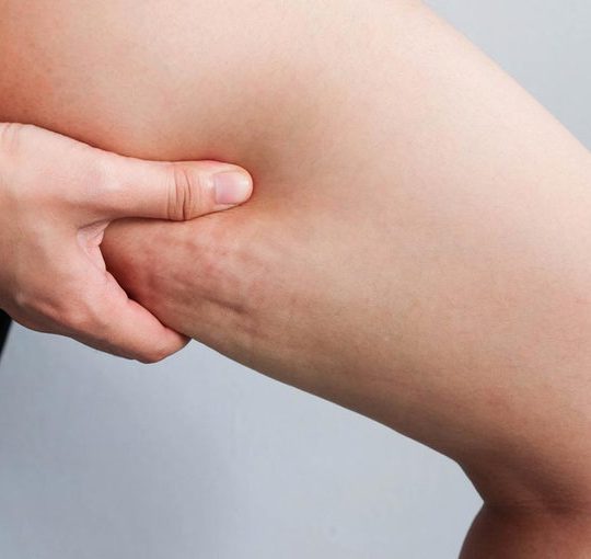 ดูดไขมัน ต้นขา ที่ไหนดี