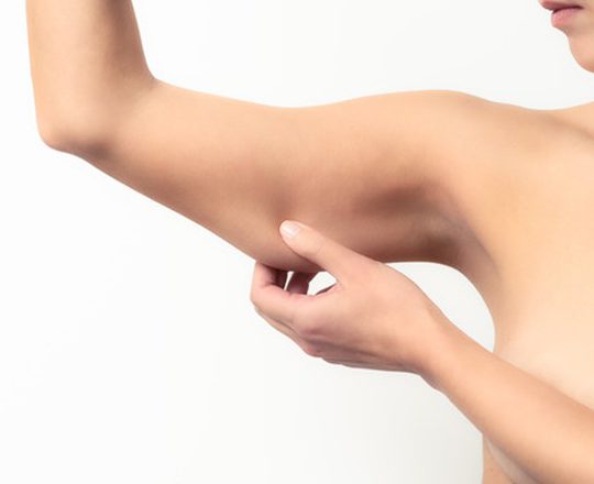 ดูดไขมัน ต้นแขน ที่ไหนดี