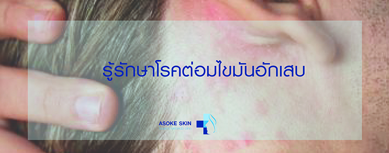 Asoke Skin Hospital โรงพยาบาลรักษาเซ็บเดิร์ม ผู้ให้บริการรักษาโรคผิวหนังเฉพาะทาง