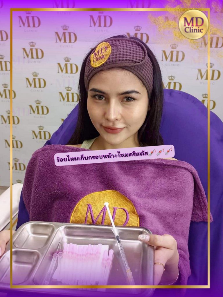 MD Clinic บริการร้อยไหม ขอนแก่น เพิ่มความกระชับ ผิวหน้าเด็กลงได้อย่างปลอดภัย - 2