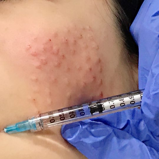 คลินิกทำรีจูรัน ที่ไหนดี - 1