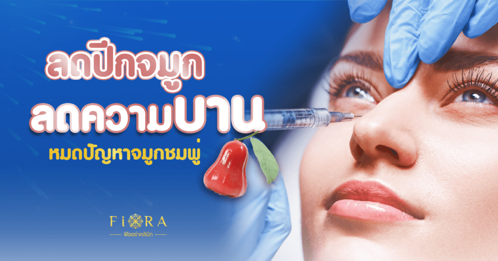 Fiora Clinic คลินิกฉีดโบท็อกซ์ปีกจมูก เทคนิคฉีดลดความบาน ปักจมูกรัดแกนอย่างเหมาะสม