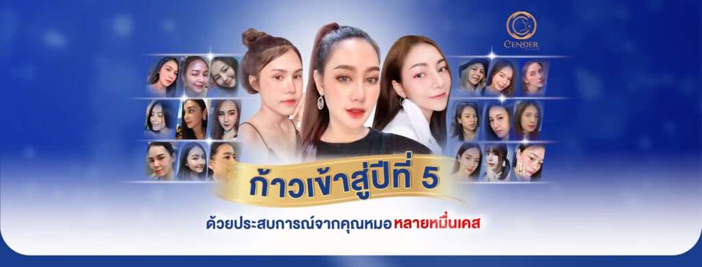 Center Clinic ศูนย์เสริมความงาม พระราม 2 เทคนิคศัลยกรรมจมูก ฉีดฟิลเลอร์ โบท็อก ร้อยไหมที่ได้คุ