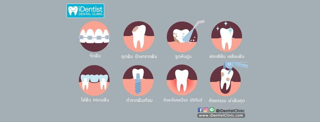 iDentist Dental Clinic รับฟอกสีฟัน เทคนิคระบบแสงเย็น ยิ้มสดใสดูดีได้ทุกมิติของใบหน้า