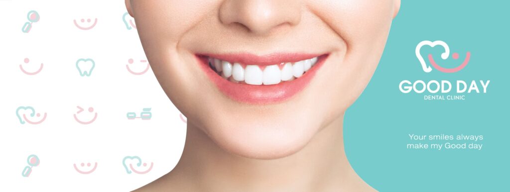 10 อันดับ ขูดหินปูน กรุงเทพ ที่ไหนดี ลดการสะสมคราบพลัคตกค้าง ฟันขาวสะอาดขึ้น 5 Good Day Dental Clinic ขูดหินปูน กรุงเทพ ลดการสะสมแบคทีเรีย คราบพลัคให้น้อยลง