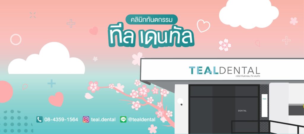 Teal Dental Clinic แก้ฟันเหลือง กรุงเทพ เติมเต็มรอยยิ้มให้สวยโดดเด่น ดูมั่นใจได้อย่างไม่ต้องกั