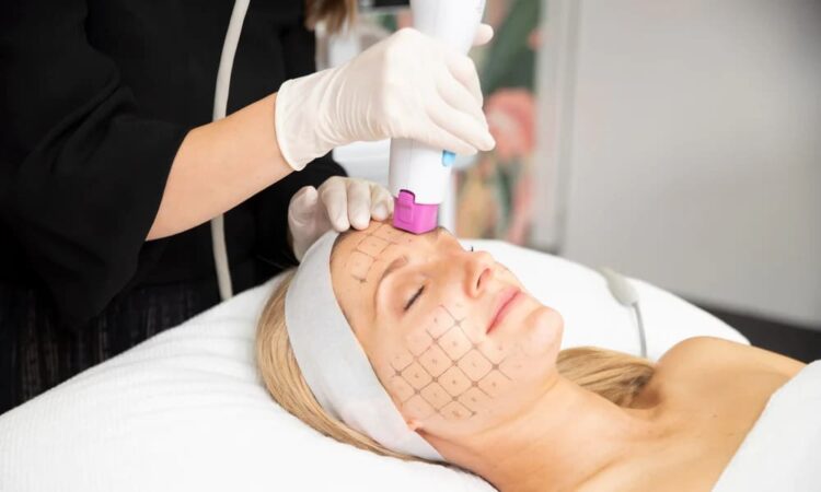 10 อันดับ คลินิก Thermage นนทบุรี ยกกระชับ ปรับหน้าเรียวสวย เป๊ะปังไม่เหมือนใคร 1 คลินิก Thermage นนทบุรี - 1