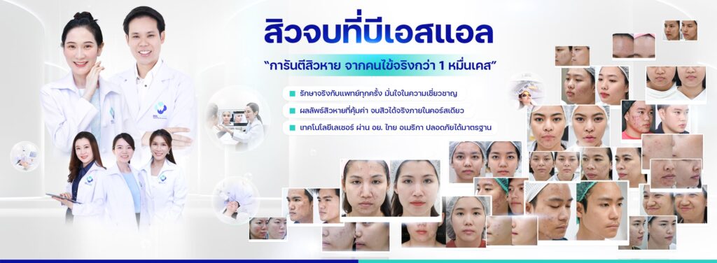 BSL Clinic บริการเลเซอร์ขนรักแร้ ลดผิวหนังไก่ เพิ่มความเต่งตึงให้รักแร้ขาวสะอาดสดใส