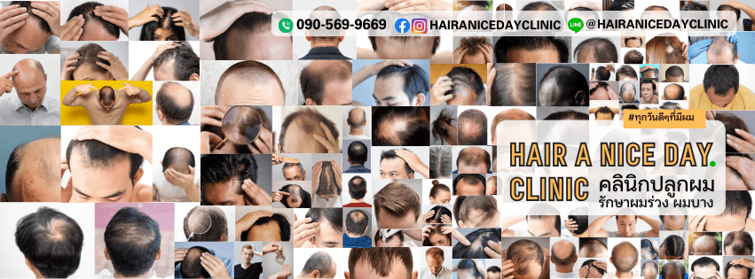 Hair a nice day Clinic คลินิกปลูกผม ระยอง คืนความมั่นใจให้ทุกสไตล์ทรงผม ปลูกสวยเด่นชัดขึ้น