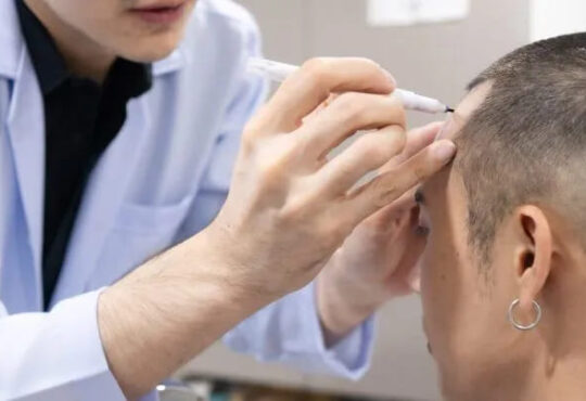 Where is a good hair transplant clinic in Chiang Mai