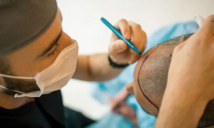 Where is a good hair transplant clinic in Chiang Rai