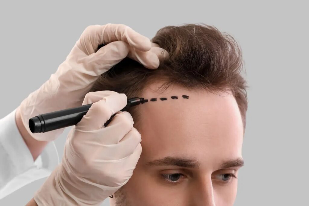 Where is a good hair transplant clinic in Chonburi