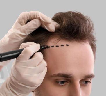 Where is a good hair transplant clinic in Chonburi