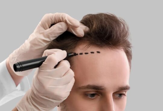Where is a good hair transplant clinic in Chonburi