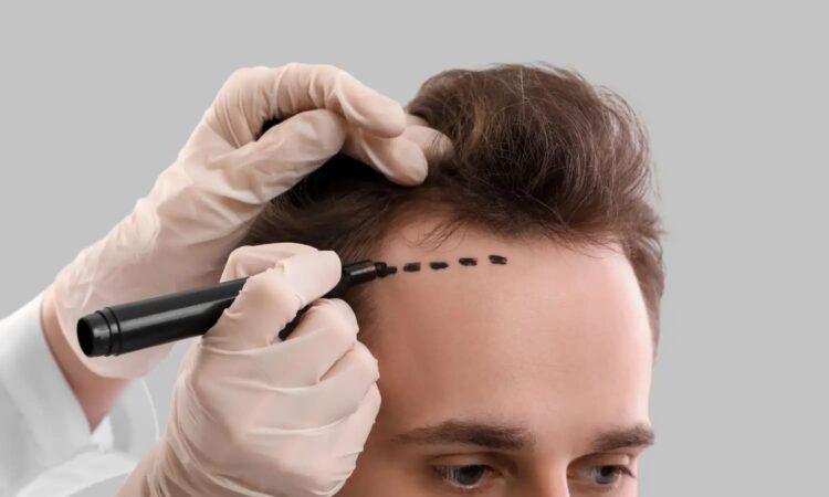 Where is a good hair transplant clinic in Chonburi