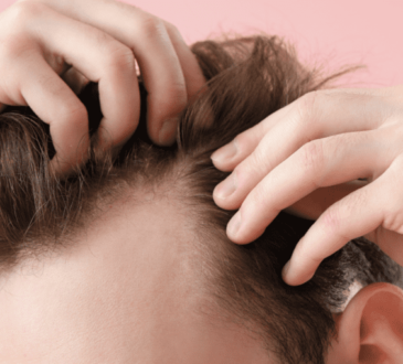 Where is a good hair transplant clinic in Nonthaburi