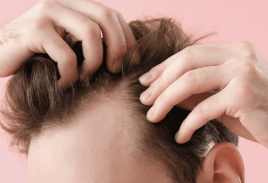 Where is a good hair transplant clinic in Nonthaburi