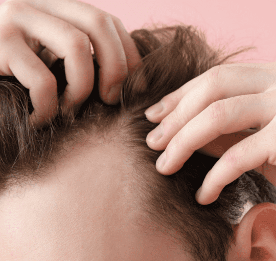 Where is a good hair transplant clinic in Nonthaburi