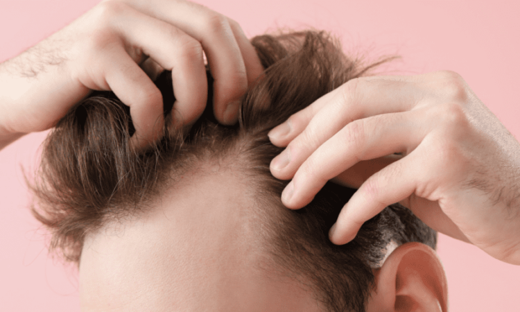 Where is a good hair transplant clinic in Nonthaburi