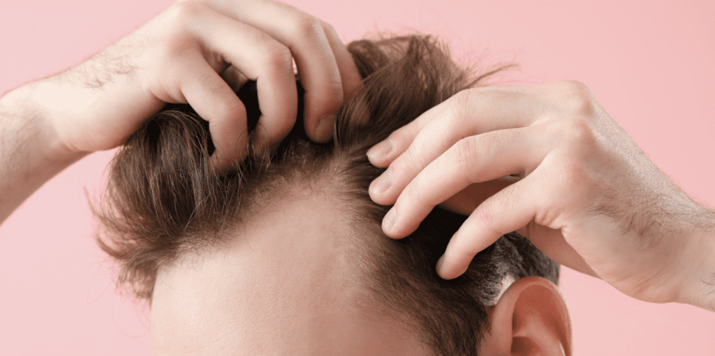 Where is a good hair transplant clinic in Nonthaburi